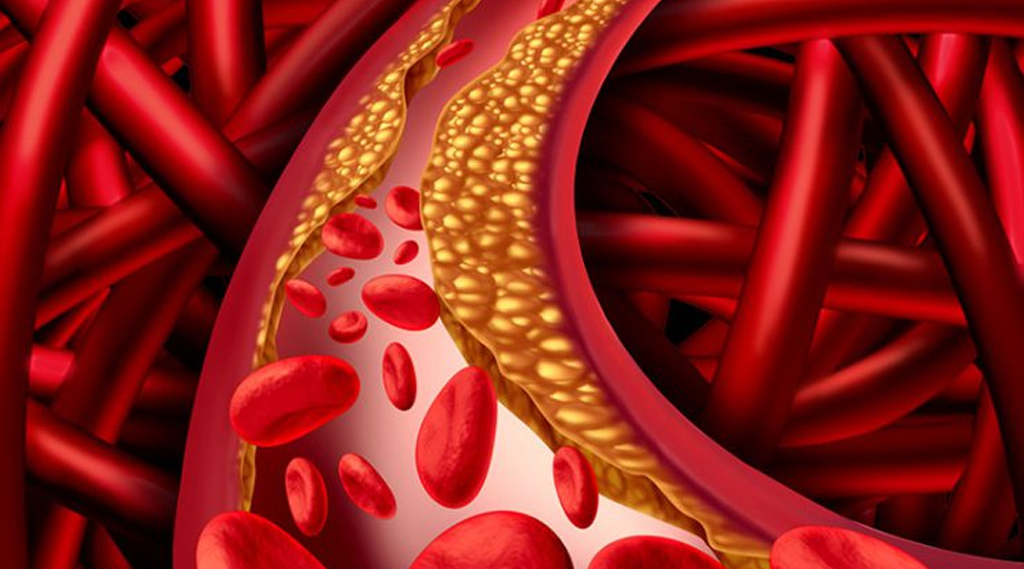 Read more about the article IAS Statin Newsletter